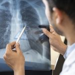What Type Of Benefit You Can Achieve When Seeing a Pulmonology Doctor