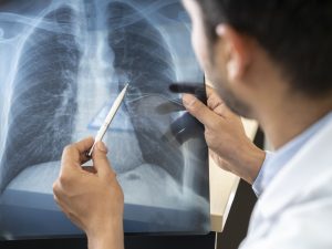 What Type Of Benefit You Can Achieve When Seeing a Pulmonology Doctor